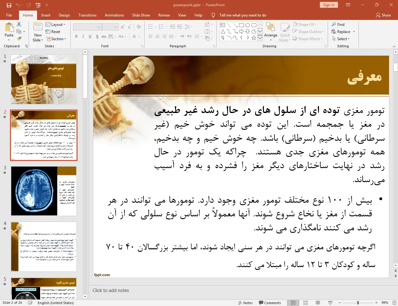 بررسی تومورهای مغزی