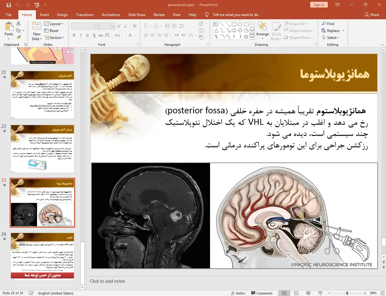 همانژیوبلاستوما