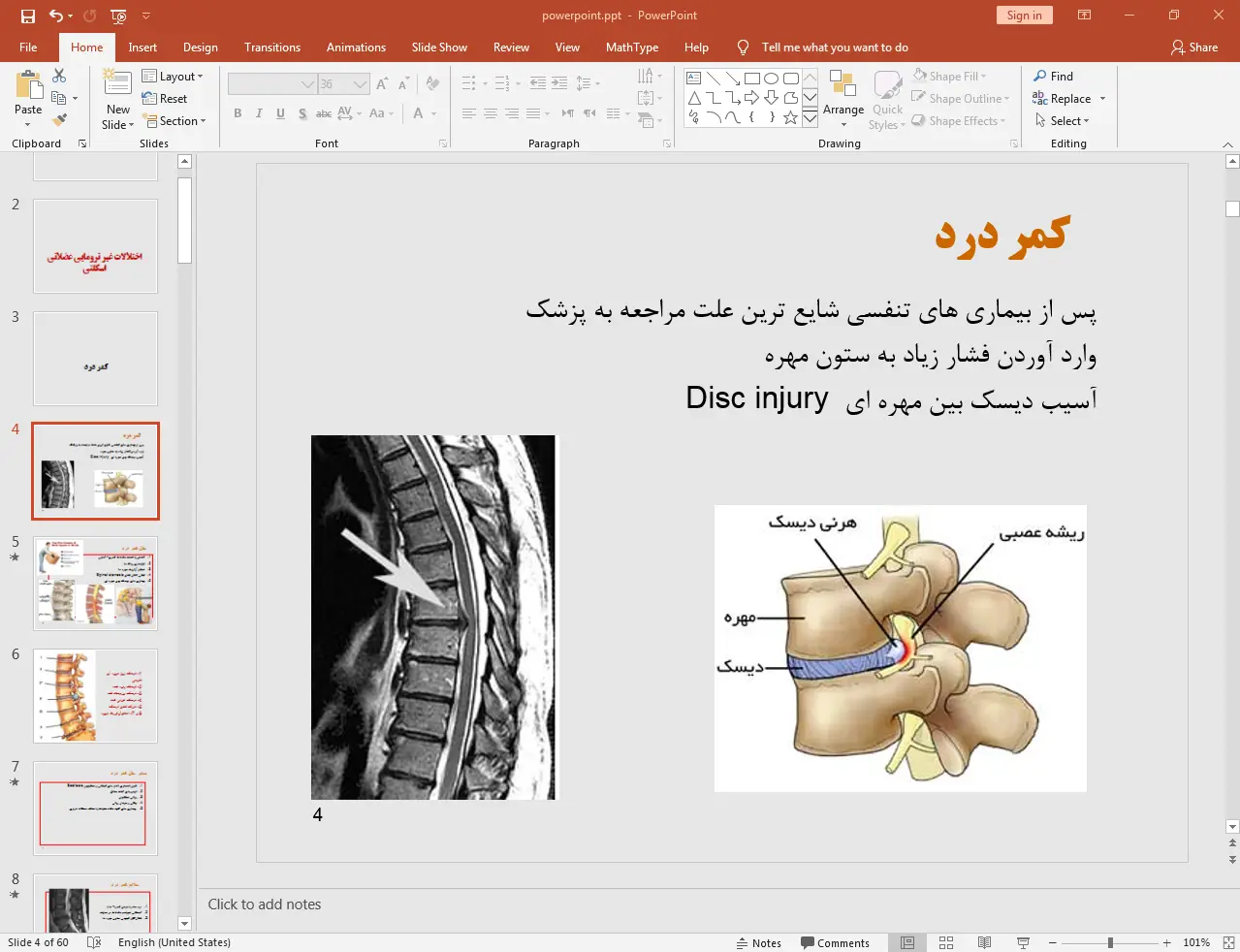 بررسی اختلالات غیر ترومایی عضلانی اسکلتی